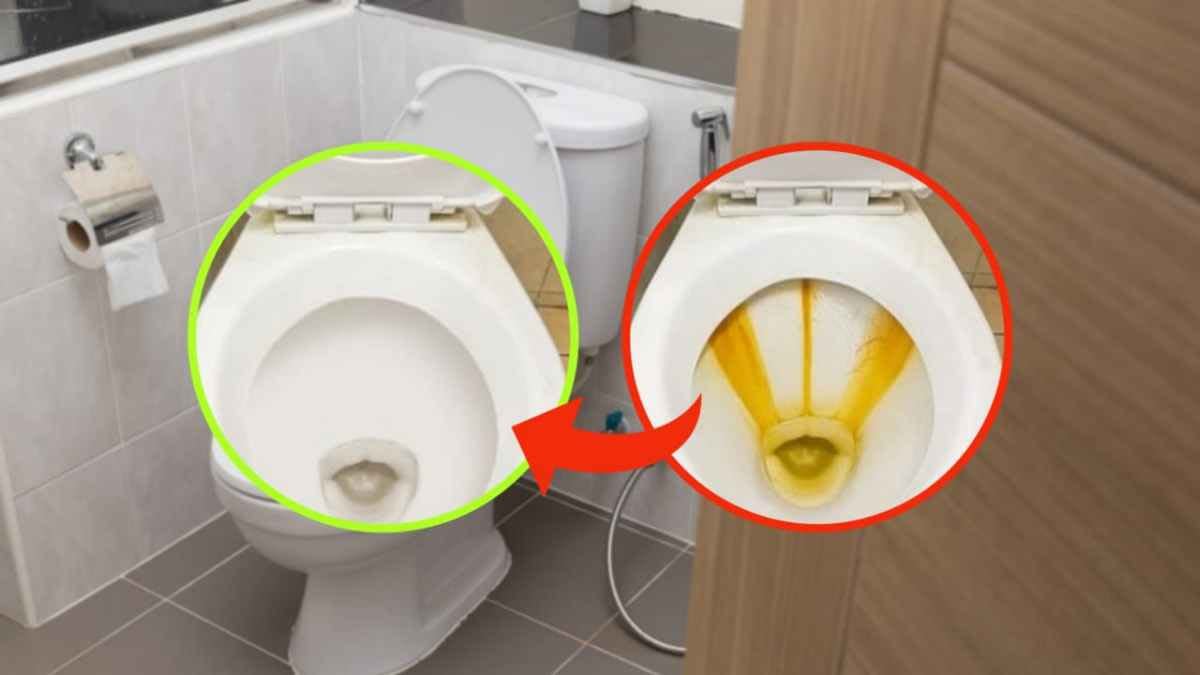 des-traces-jaunes-de-calcaire-genantes-sur-les-toilettes-comment-les-enlever-dun-simple-geste